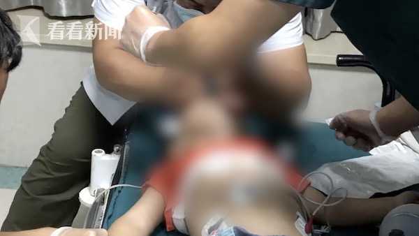 命悬一线！2岁男童吞下钢珠被卡住气管 昏迷2个多小时休闲区蓝鸢梦想 - Www.slyday.coM