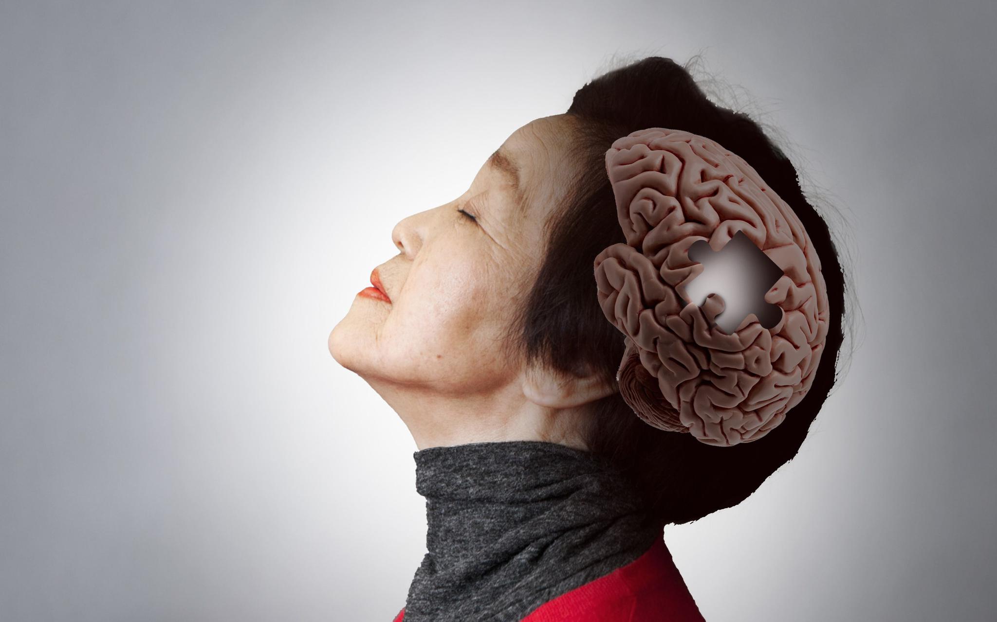 阿尔茨海默症有哪些症状 老年人患老年痴呆后的表现和判断方法