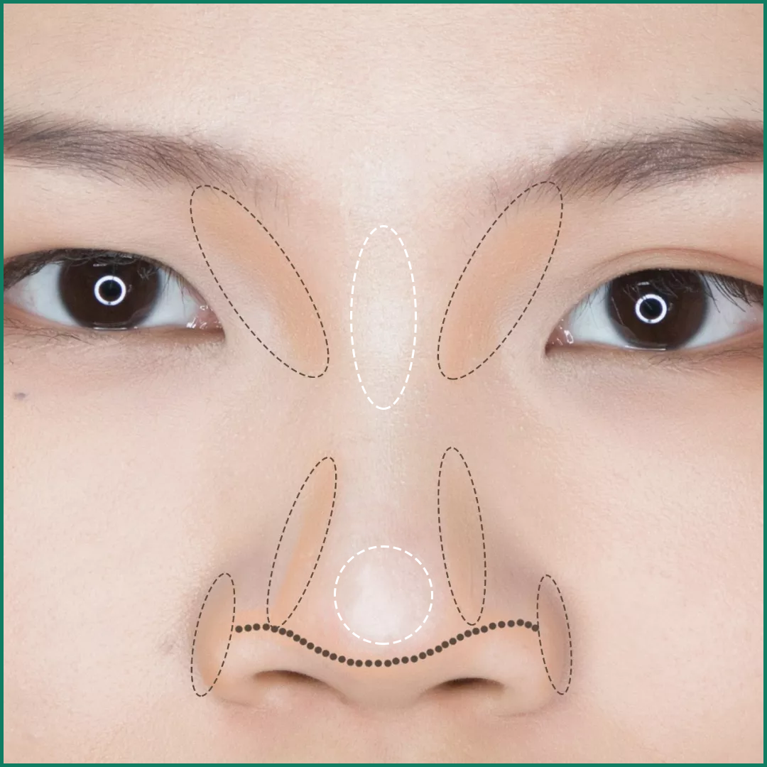 【鼻子审美】好看的鼻子有哪些条件？①鼻额角过渡自然_圈子-新氧美容整形