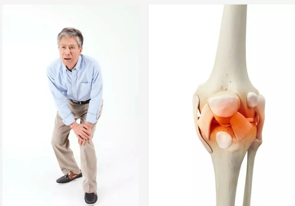 治疗膝关节骨病看这篇就够了