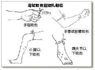 仅惠州这家医院今年接诊108例蛇咬伤!|蝰蛇|惠州|血清_新浪新闻