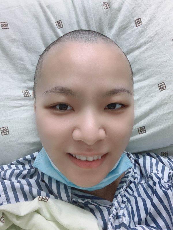 曹淑嫣为了治疗把头发剃光了。受访者供图
