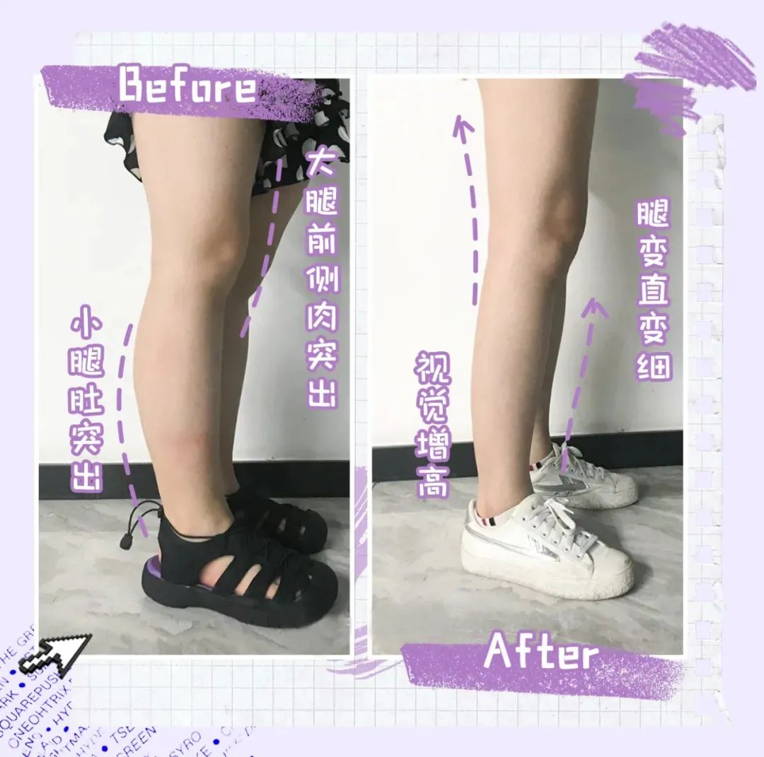 腿粗的女生求求你别乱穿了!这样穿一个月掉10斤,睡觉都在瘦!