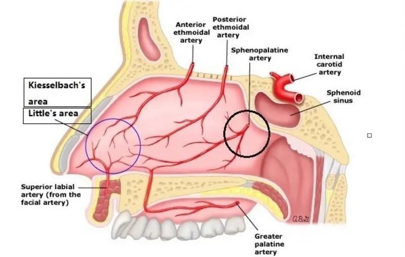 孩子反复流鼻血,是得了白血病吗?
