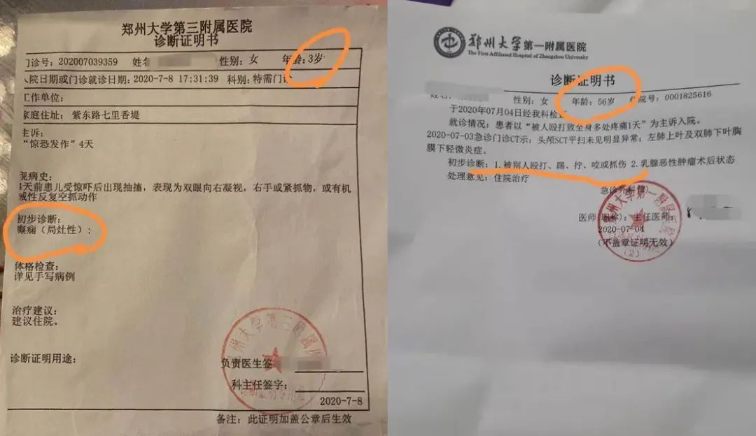 医院开具的诊断证明显示,3岁女童受惊吓后出现抽搐等局灶性癫痫