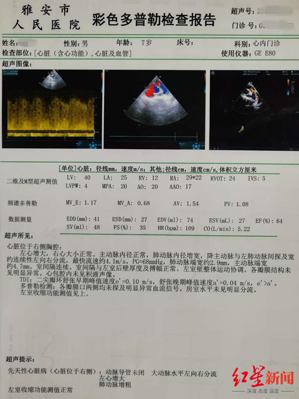 患先心病且天生只有半边肺 7岁男孩家境贫困一直没手术 医生伸出援手