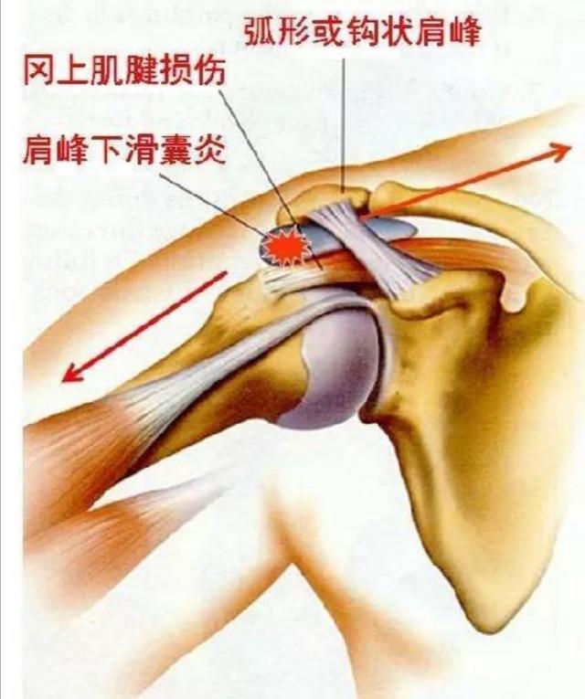 那么这块空隙里,实际上它不是空白的,它里面有一些肌腱穿行而过,肌腱