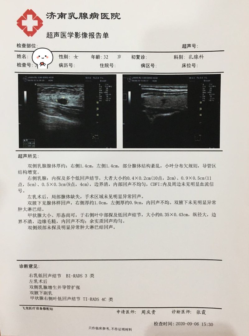 济南乳腺病医院:乳腺癌术后4年复查 意外发现甲状腺出事了!