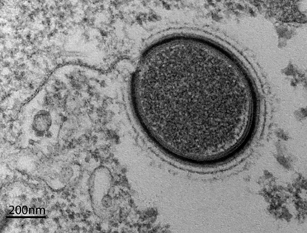 这说明什么问题,人类更加不安的可能还是远古病毒的出现,这个比气候