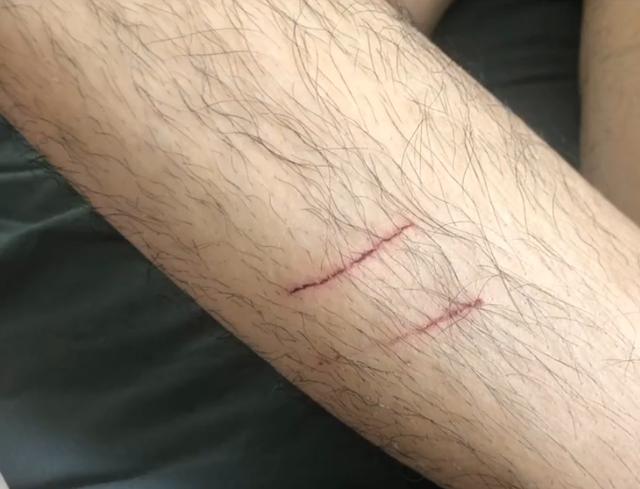 关系,所以主动跟猫咪套近乎,但其男朋友刚靠近猫咪,就被猫咪抓伤了