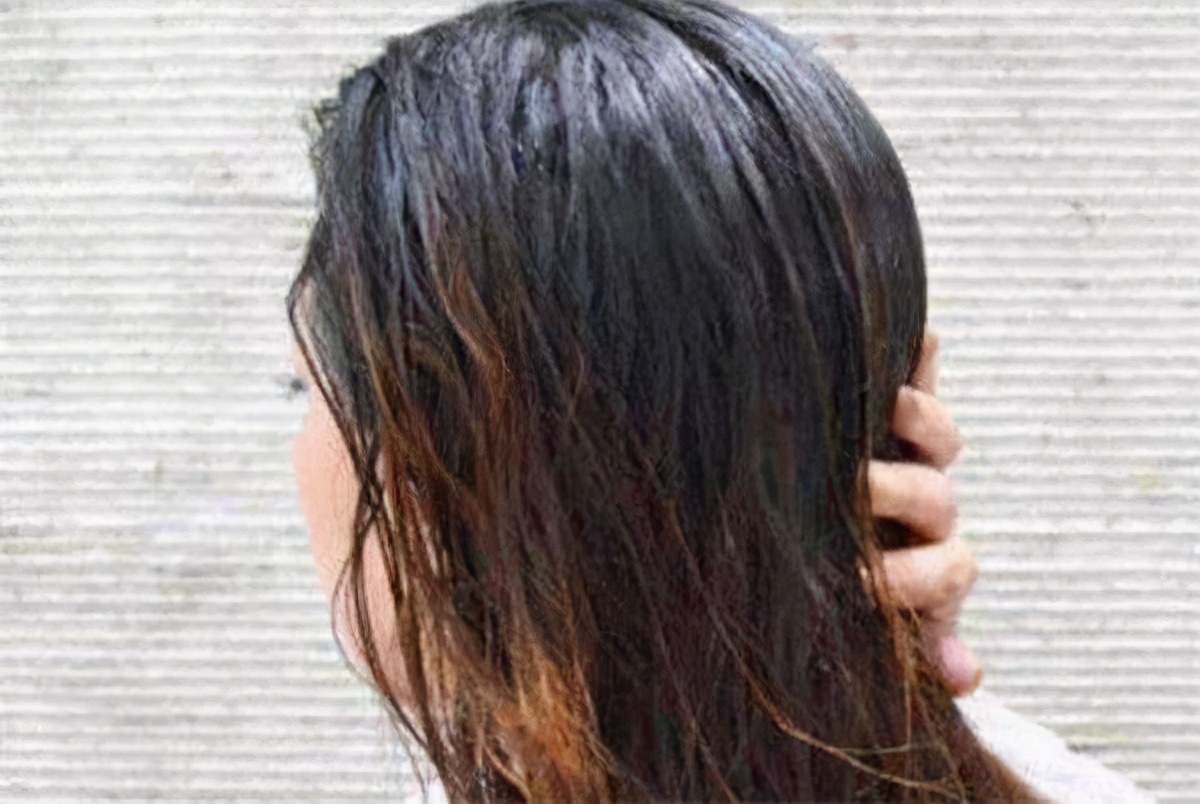 秋冬季节头皮出油多,应该如何解决?