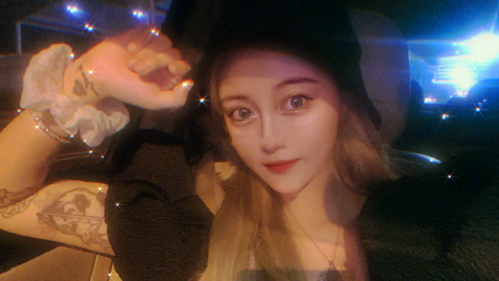 25岁心梗猝死的孙侨潞为了变美,3年前打美白针,差点脑出血!