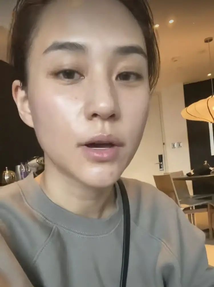 何超莲晒医美近照除去滤镜素颜很醒目有痘印反而更显真实度