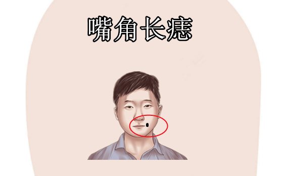 身上4颗辛苦痣三天两头没钱花饥一顿饱一顿打一辈子工