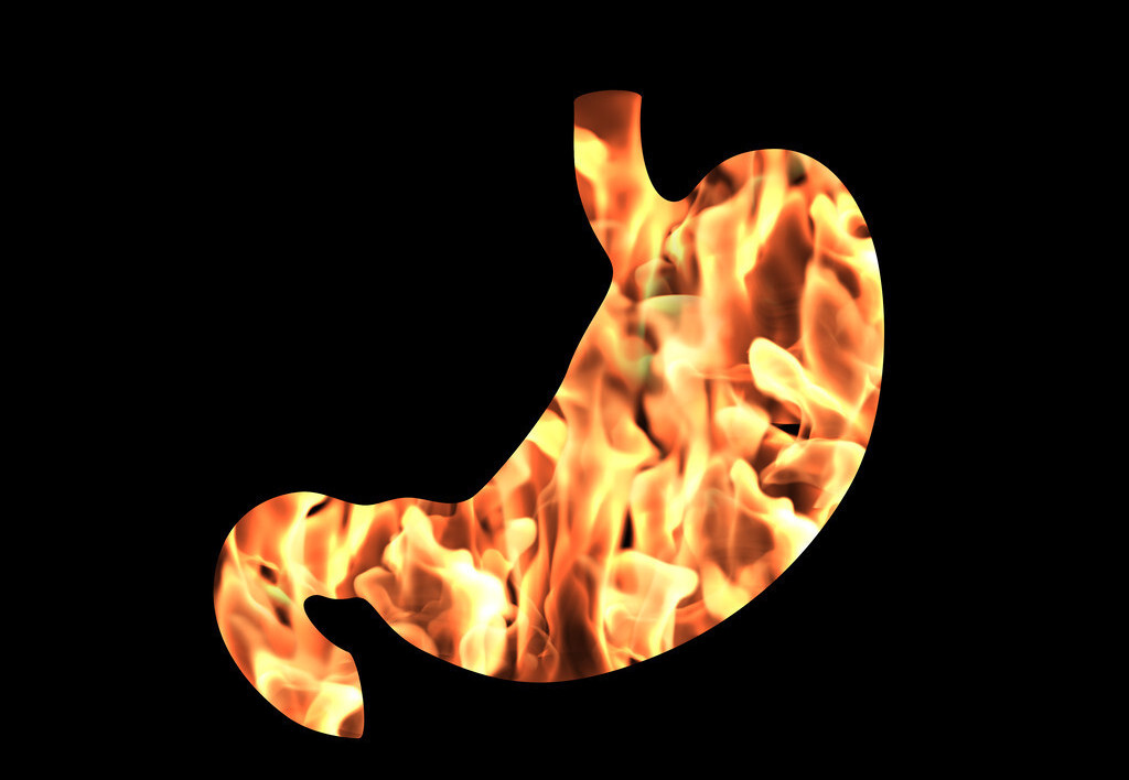 胃火旺的人身体通常会发出6个提示一发现尽早降火养胃