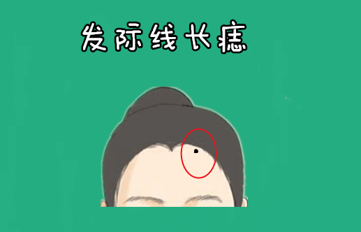 发际线有痣女人图片