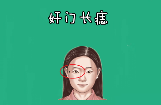 身体5颗"破财"痣,大钱净小钱光,打一辈子工,白辛苦一场!