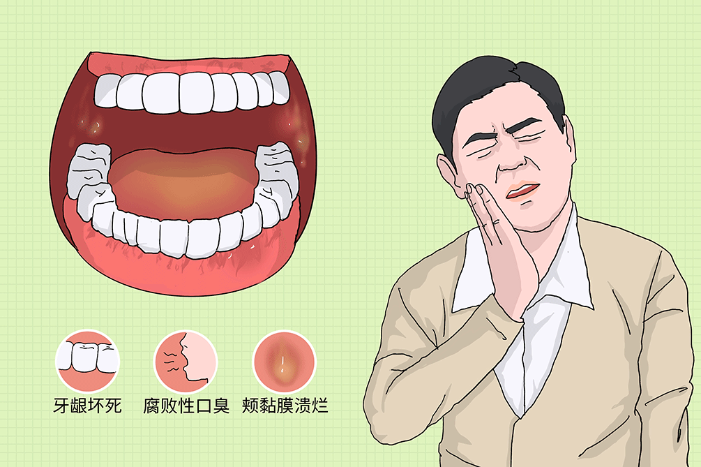 口腔炎是什么|口角|口腔炎|黏膜_新浪新闻