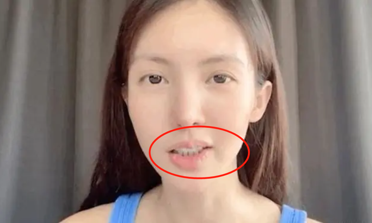 金晨嘴歪确实非常明显,尤其素颜,那嘴巴歪的,简直像被人打了一拳整个