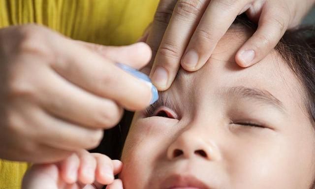 孩子喜欢揉眼睛,可能是这三个原因引起的!