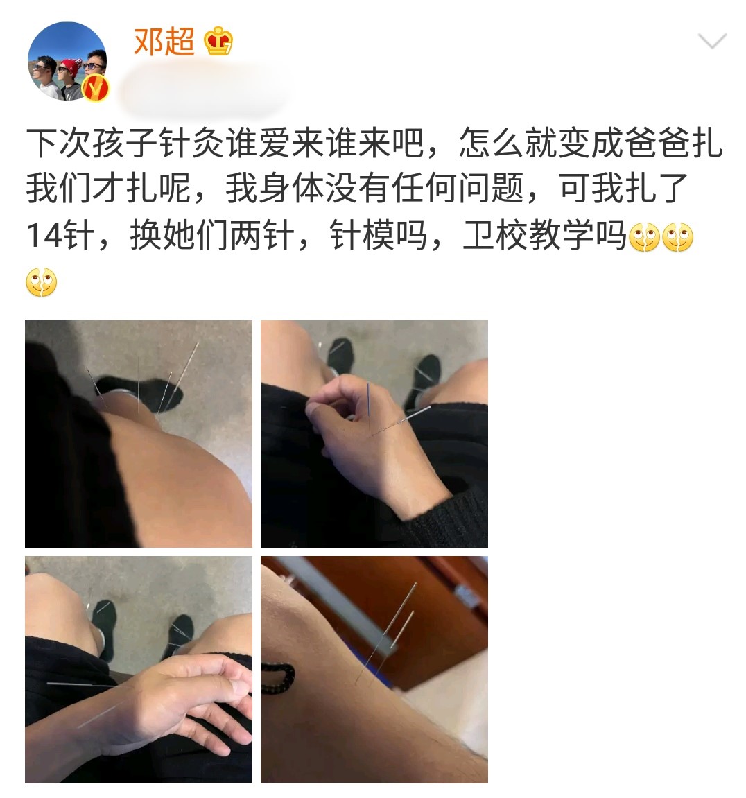 邓超被扎14针图片