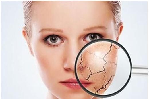 告别敏感肌肤的三大方法,学会再也不用担心皮肤脆弱