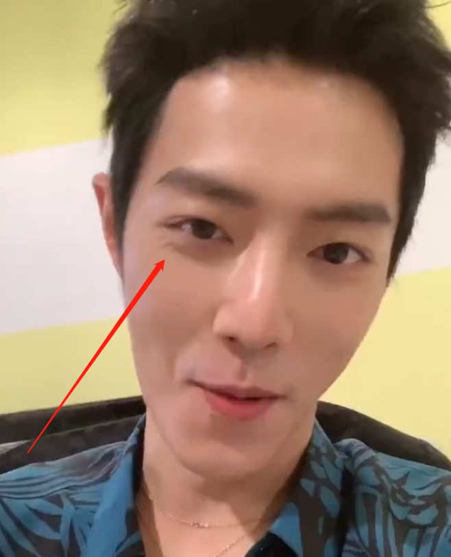 肖战候场无聊玩自拍,开特效做搞怪表情,我却在关注他的肌肤|肖战|特效