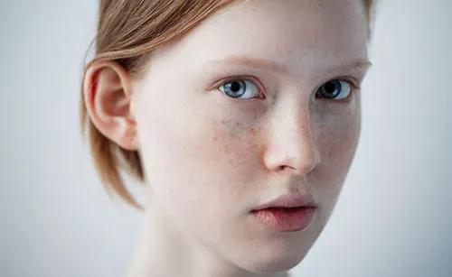 你知道干性皮肤该怎么保养吗快进来做笔记