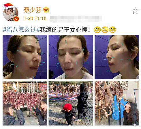 张晋蔡少芬腊八节做针灸,娘娘为保冻颜满脸扎针,三个儿女齐出镜