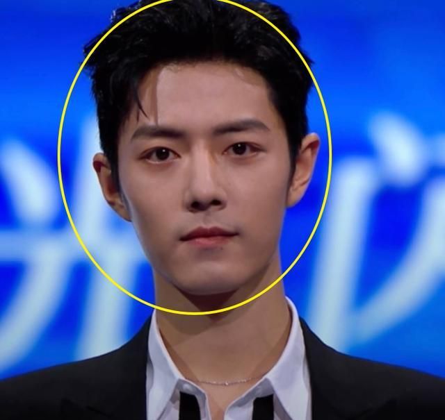 肖战盛典生图曝光,生图下颜值堪比精修,黑眼圈却成缺永远的痛?