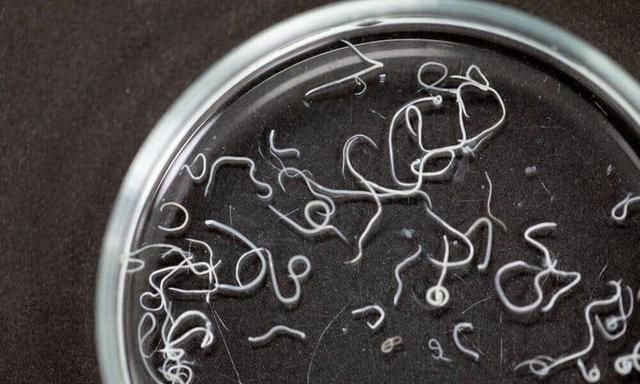 恶心的蛔虫:小时候大家都见过,为什么现在都不见了?