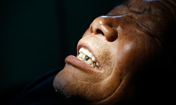 经常吸烟的人交友会熏黄牙齿,因此经常线内牙齿会变黄变黑的现象,而且