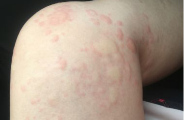 "冷"真的会要命?丨蝌学问答