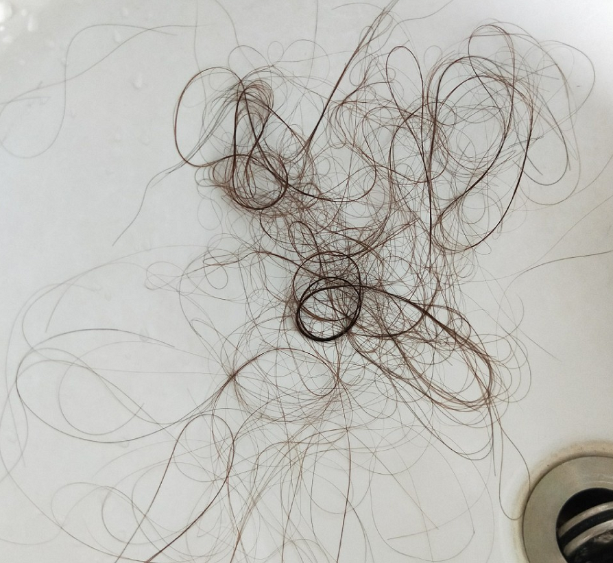 ⊱每天洗头会变秃？别信土办法，这招教你解决掉发、脱发！休闲区蓝鸢梦想 - Www.slyday.coM