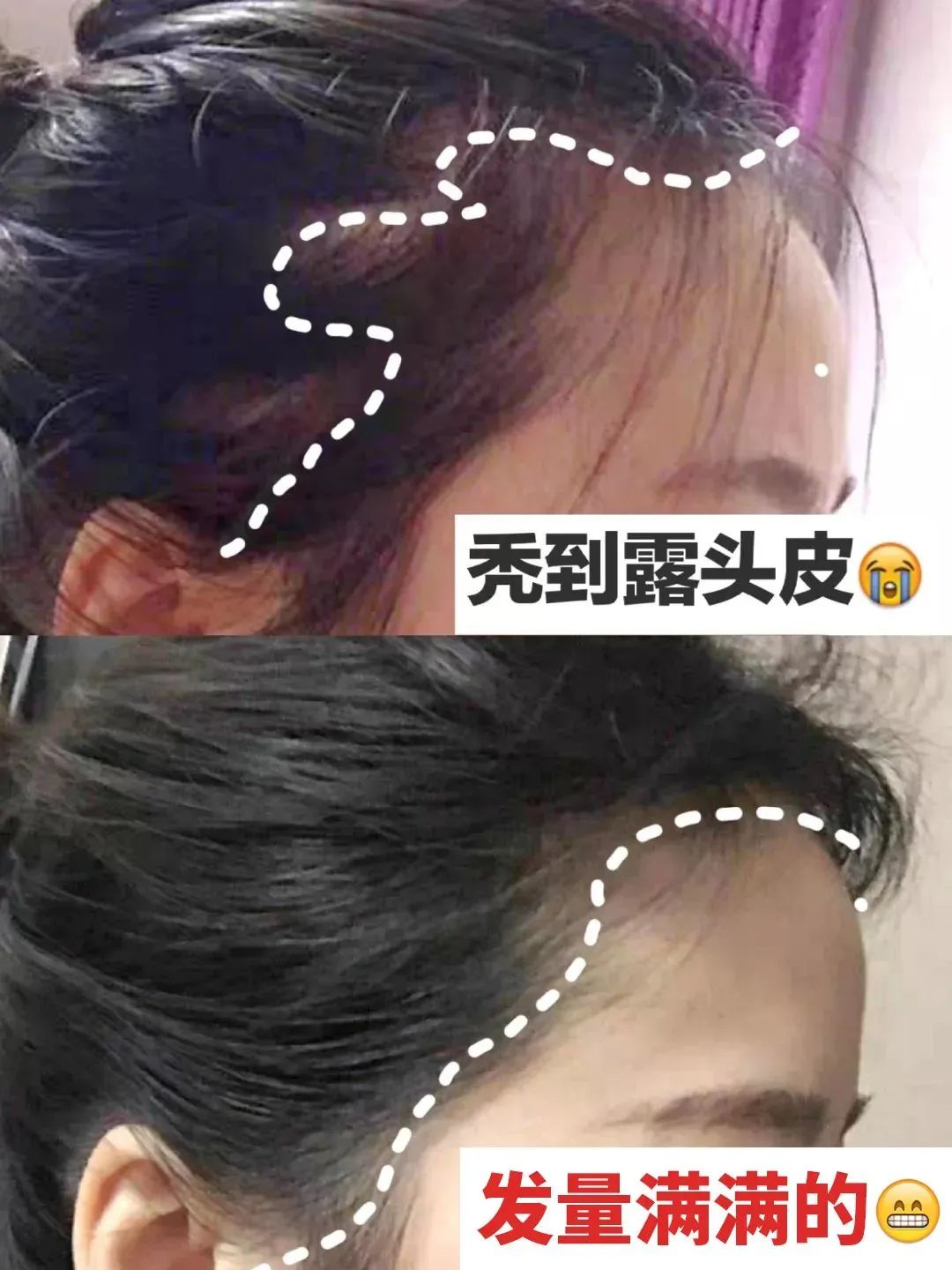 ⊱每天洗头会变秃？别信土办法，这招教你解决掉发、脱发！休闲区蓝鸢梦想 - Www.slyday.coM