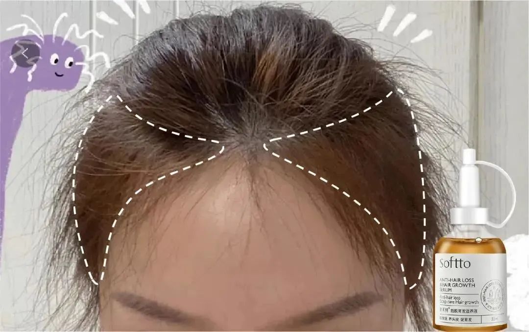 ⊱每天洗头会变秃？别信土办法，这招教你解决掉发、脱发！休闲区蓝鸢梦想 - Www.slyday.coM