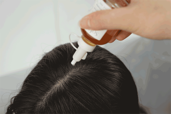 ⊱每天洗头会变秃？别信土办法，这招教你解决掉发、脱发！休闲区蓝鸢梦想 - Www.slyday.coM