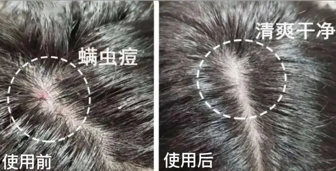 ⊱每天洗头会变秃？别信土办法，这招教你解决掉发、脱发！休闲区蓝鸢梦想 - Www.slyday.coM