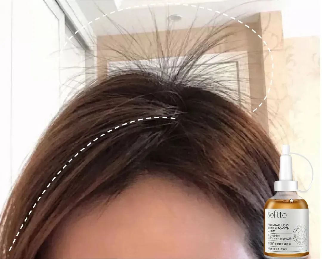 ⊱每天洗头会变秃？别信土办法，这招教你解决掉发、脱发！休闲区蓝鸢梦想 - Www.slyday.coM