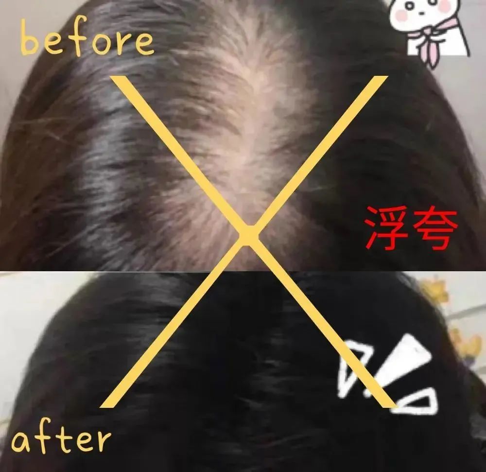 ⊱每天洗头会变秃？别信土办法，这招教你解决掉发、脱发！休闲区蓝鸢梦想 - Www.slyday.coM