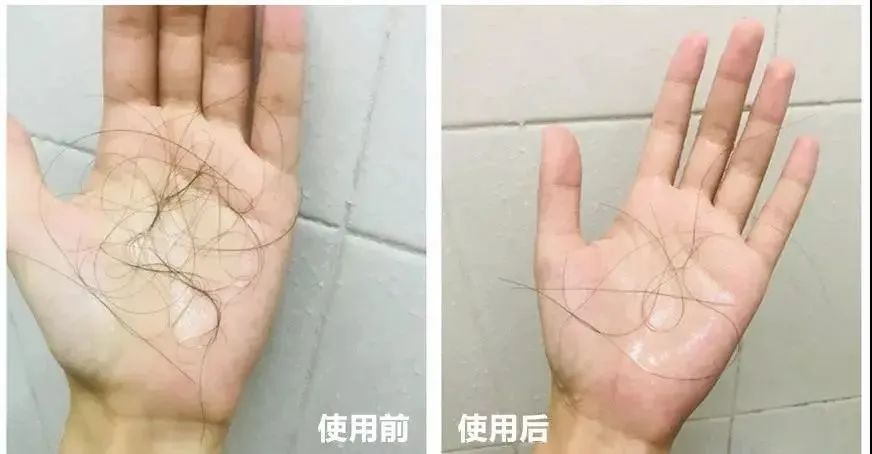 ⊱每天洗头会变秃？别信土办法，这招教你解决掉发、脱发！休闲区蓝鸢梦想 - Www.slyday.coM