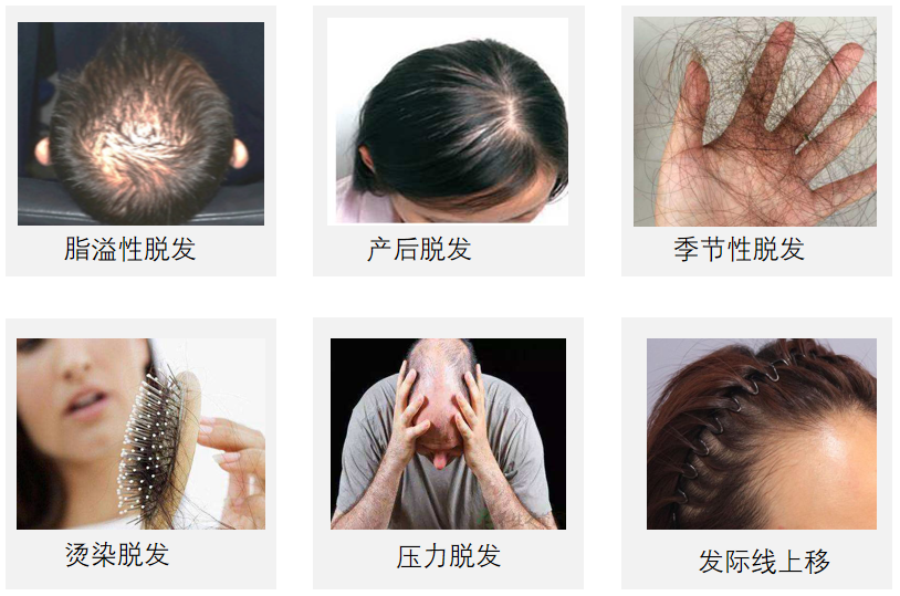 ⊱每天洗头会变秃？别信土办法，这招教你解决掉发、脱发！休闲区蓝鸢梦想 - Www.slyday.coM