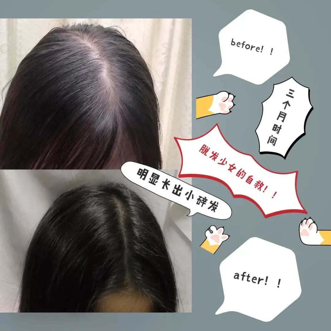 ⊱每天洗头会变秃？别信土办法，这招教你解决掉发、脱发！休闲区蓝鸢梦想 - Www.slyday.coM