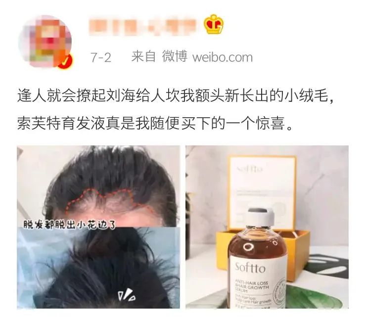 ⊱每天洗头会变秃？别信土办法，这招教你解决掉发、脱发！休闲区蓝鸢梦想 - Www.slyday.coM