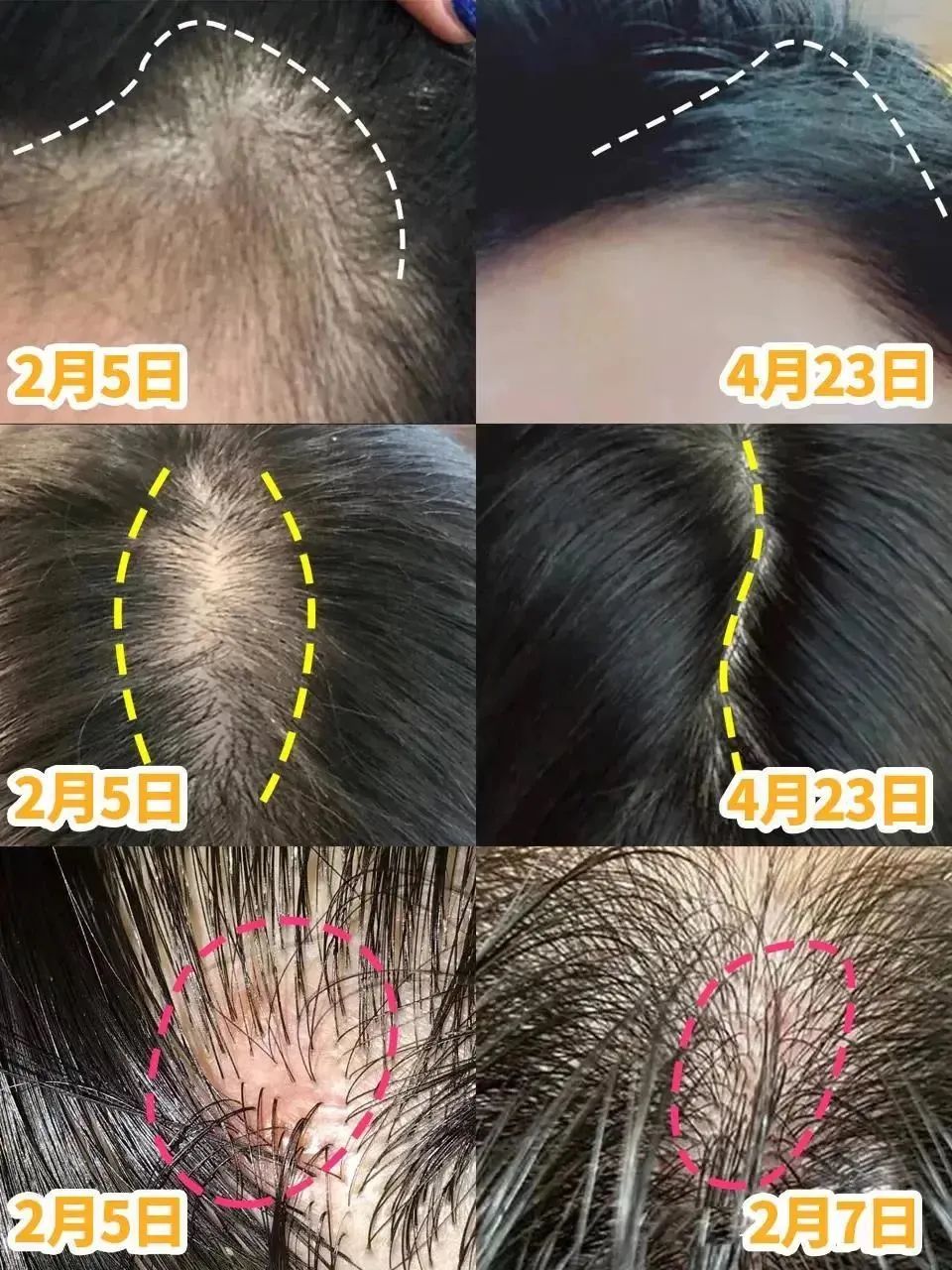 ⊱每天洗头会变秃？别信土办法，这招教你解决掉发、脱发！休闲区蓝鸢梦想 - Www.slyday.coM