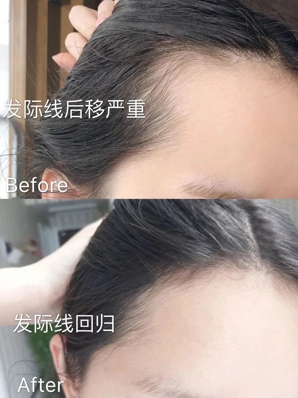 ⊱每天洗头会变秃？别信土办法，这招教你解决掉发、脱发！休闲区蓝鸢梦想 - Www.slyday.coM