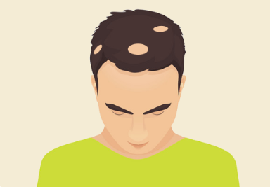 ⊱每天洗头会变秃？别信土办法，这招教你解决掉发、脱发！休闲区蓝鸢梦想 - Www.slyday.coM