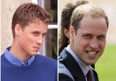 ⊱每天洗头会变秃？别信土办法，这招教你解决掉发、脱发！休闲区蓝鸢梦想 - Www.slyday.coM