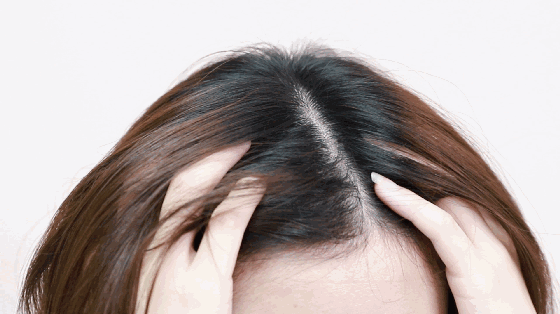 ⊱每天洗头会变秃？别信土办法，这招教你解决掉发、脱发！休闲区蓝鸢梦想 - Www.slyday.coM