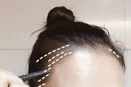 ⊱每天洗头会变秃？别信土办法，这招教你解决掉发、脱发！休闲区蓝鸢梦想 - Www.slyday.coM